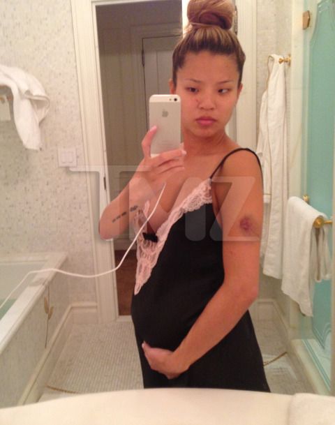  photo lydia-nam-the-dream-pregnant-injury-photos-016-480w.jpg